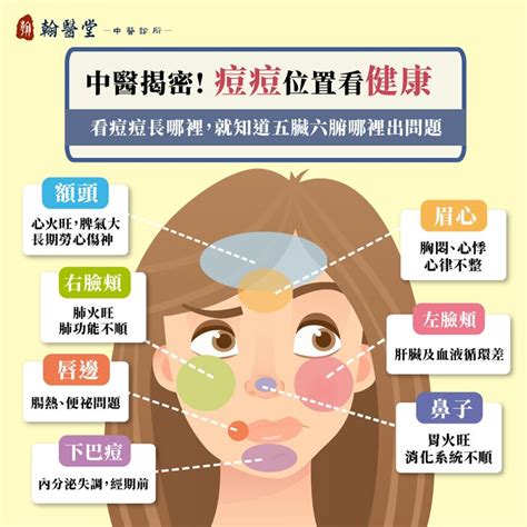 眉毛裡長痘痘|眉毛、人中長痘痘的原因？10個「青春痘位置」對應你。